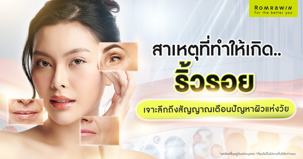 สาเหตุที่ทำให้เกิดริ้วรอยมีอะไรบ้าง? ควรรับมือ และป้องกันอย่างไร