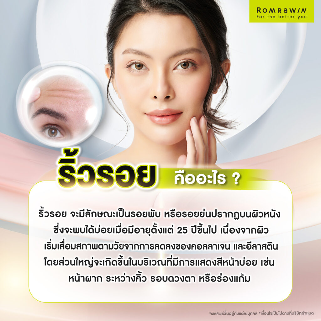 ริ้วรอย คืออะไร?