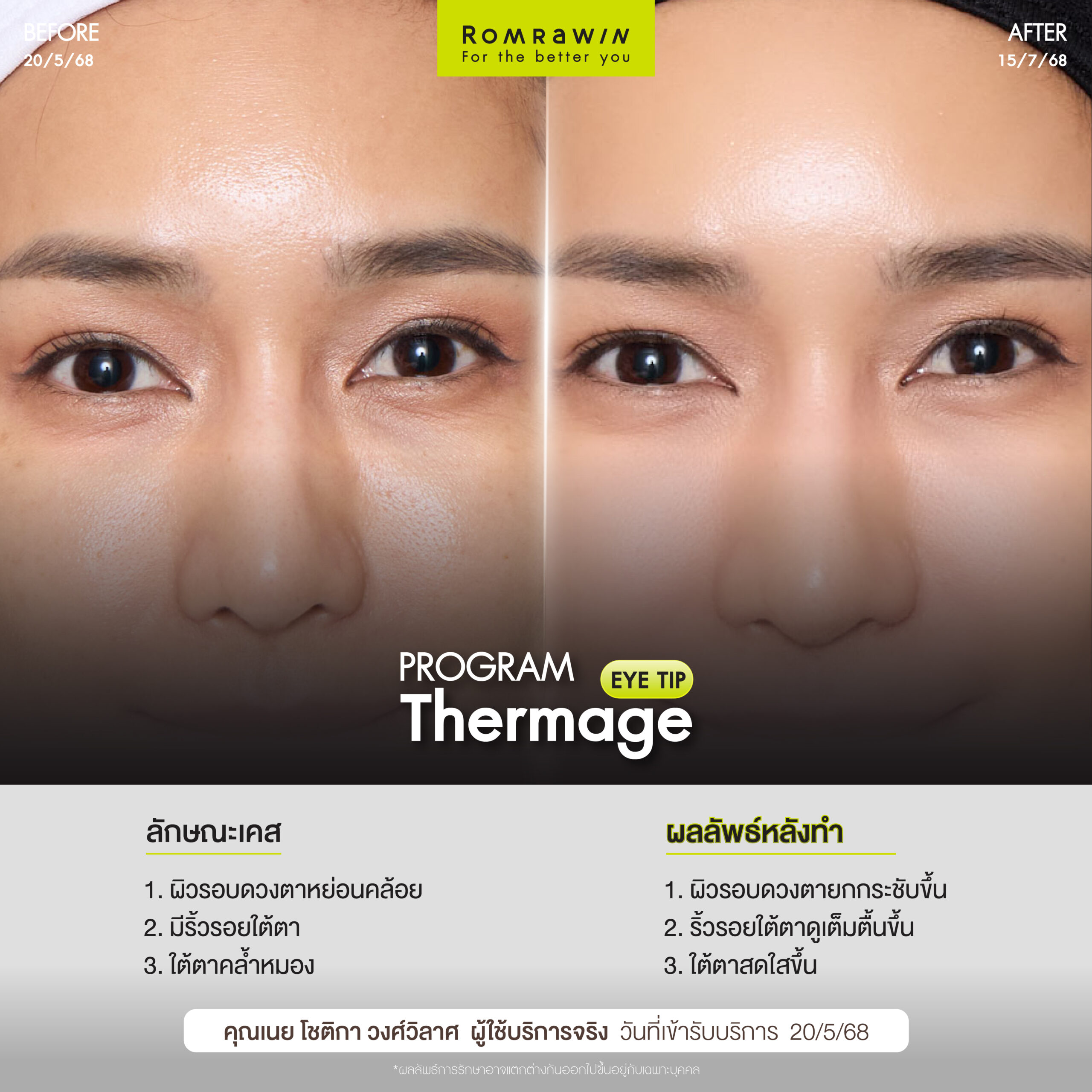 ผลลัพธ์ขึ้นอยู่กับแต่ละบุคคล