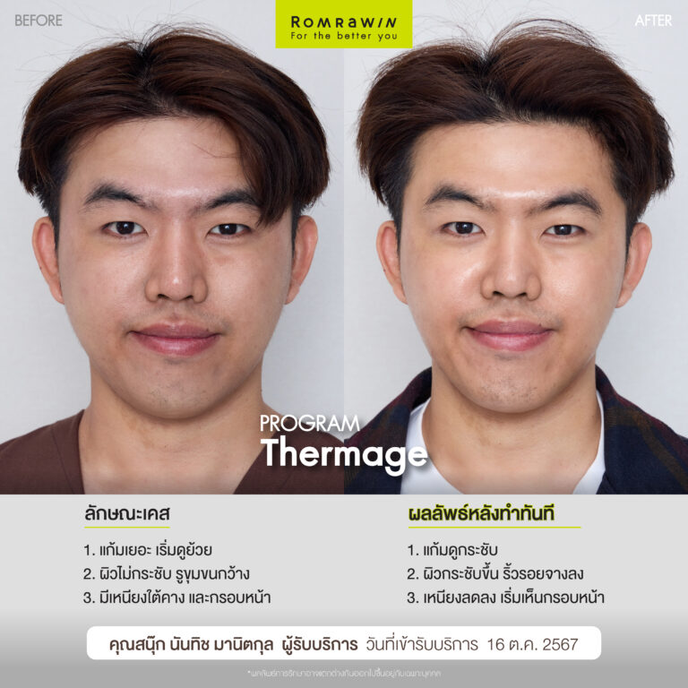 BF AT คุณสนุ๊ก 01 0