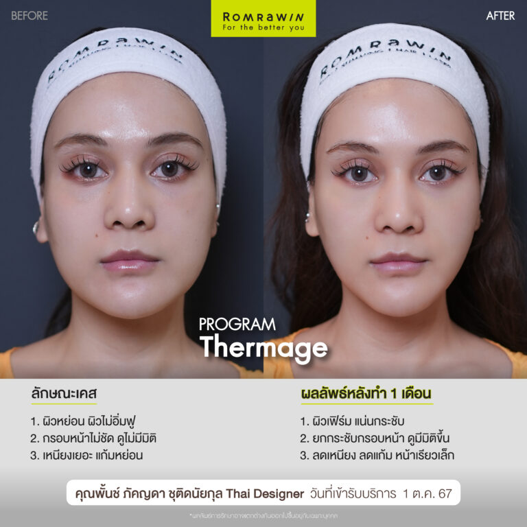 พั้นช์ ภัคญดา