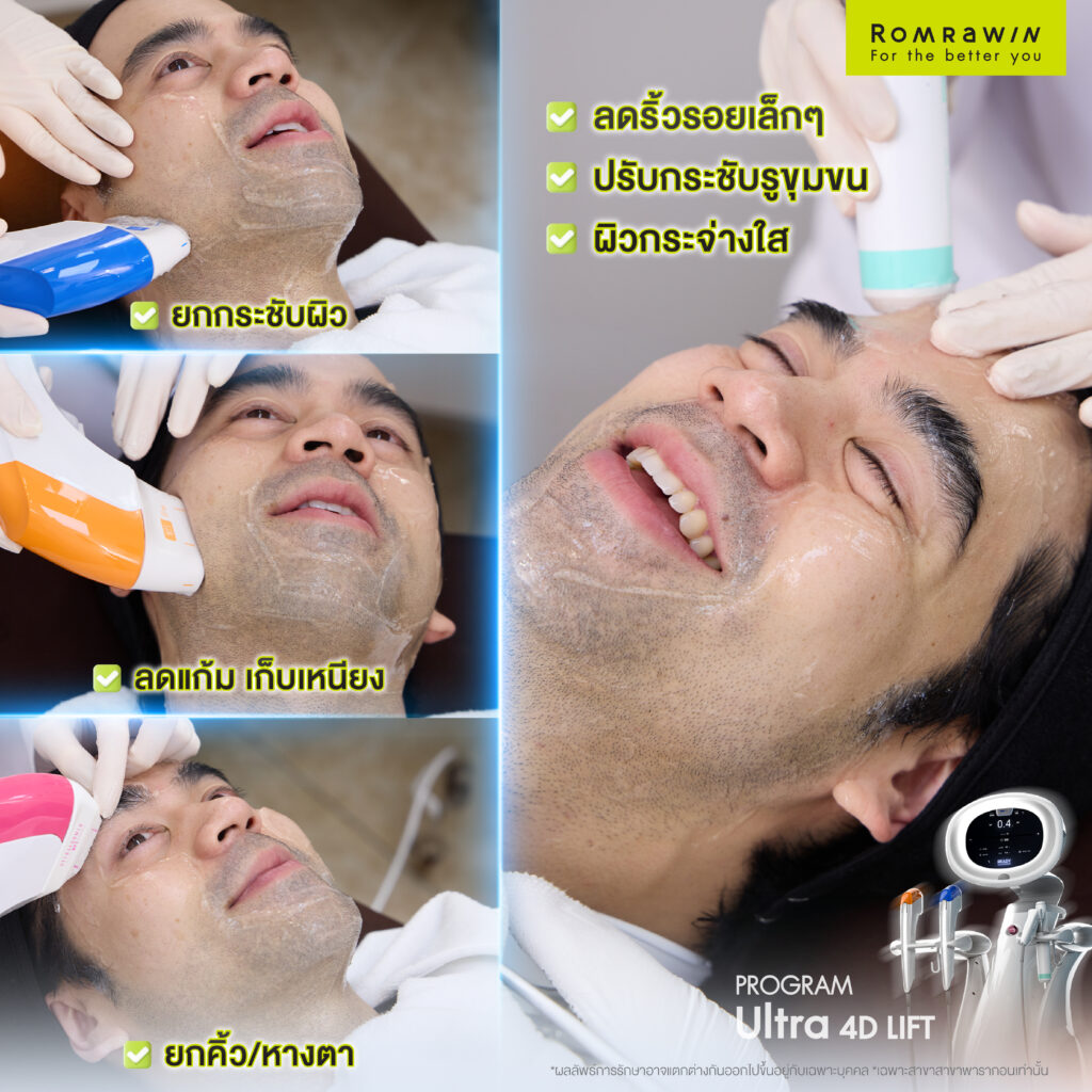 หน้าคุณแอลยกจริง Ultra 4D LIFT เครื่องนี้เวิร์กจริง