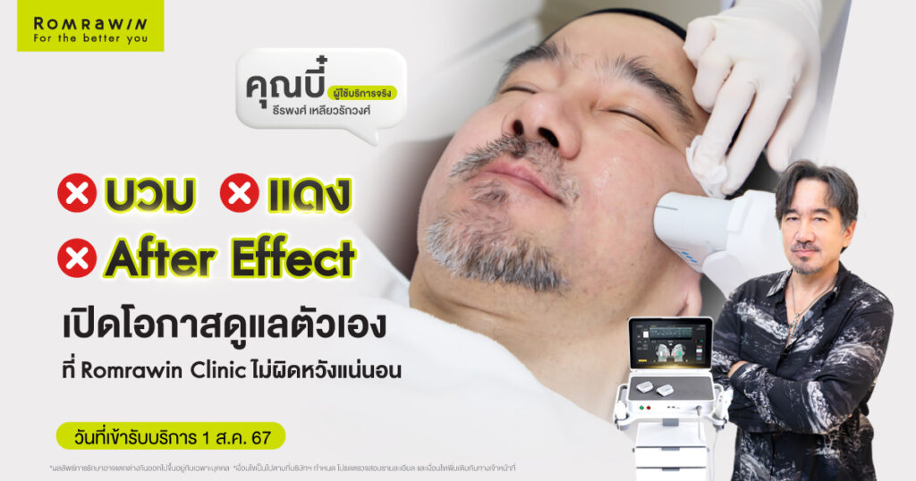 คุณบี๋ ธีรพงศ์ขอเปิดโอกาสดูแลตัวเองอีกครัง ด้วย Ultherapy PRIME  1 คุณบี๋ ธีรพงศ์ขอเปิดโอกาสดูแลตัวเองอีกครัง ด้วย Ultherapy PRIME