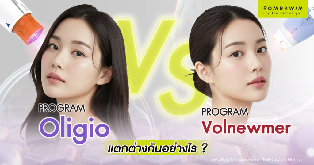 Oligio กับ Volnewmer แตกต่างกันอย่างไร