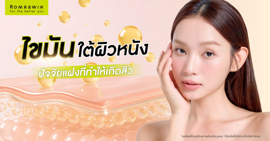 ไขมันใต้ผิวหนัง ปัจจัยแฝงที่ทำทำให้เกิดสิว 1 ไขมันใต้ผิวหนัง