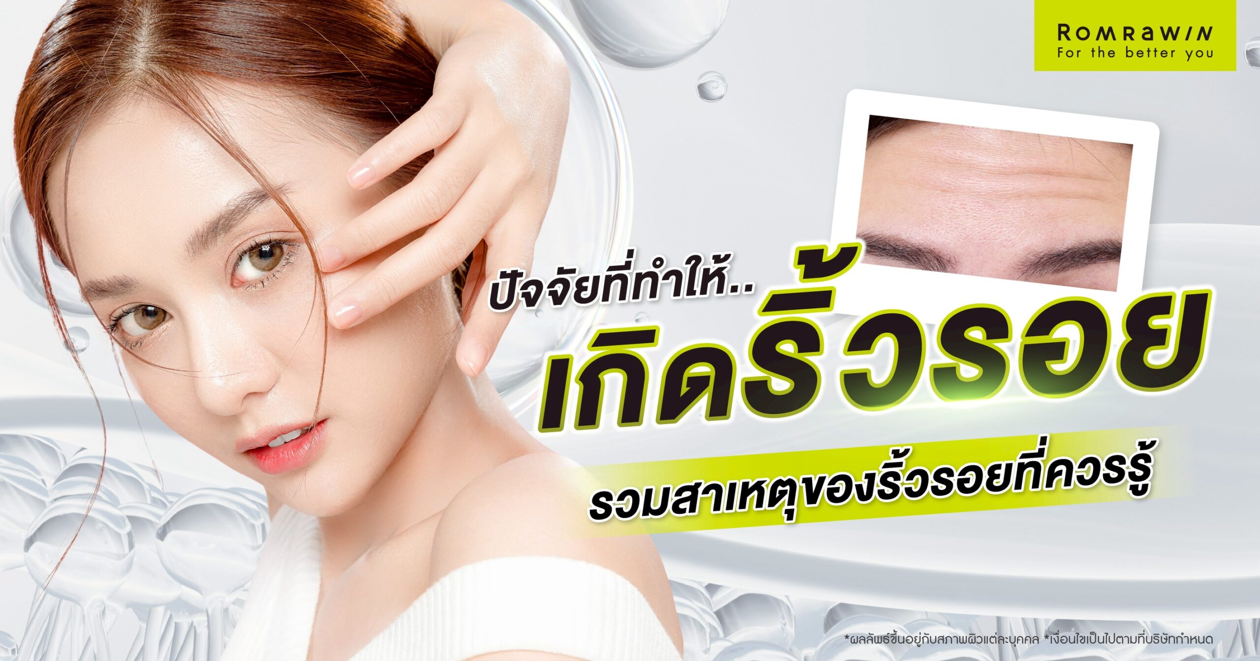 ปัจจัยที่ทำให้เกิดริ้วรอย