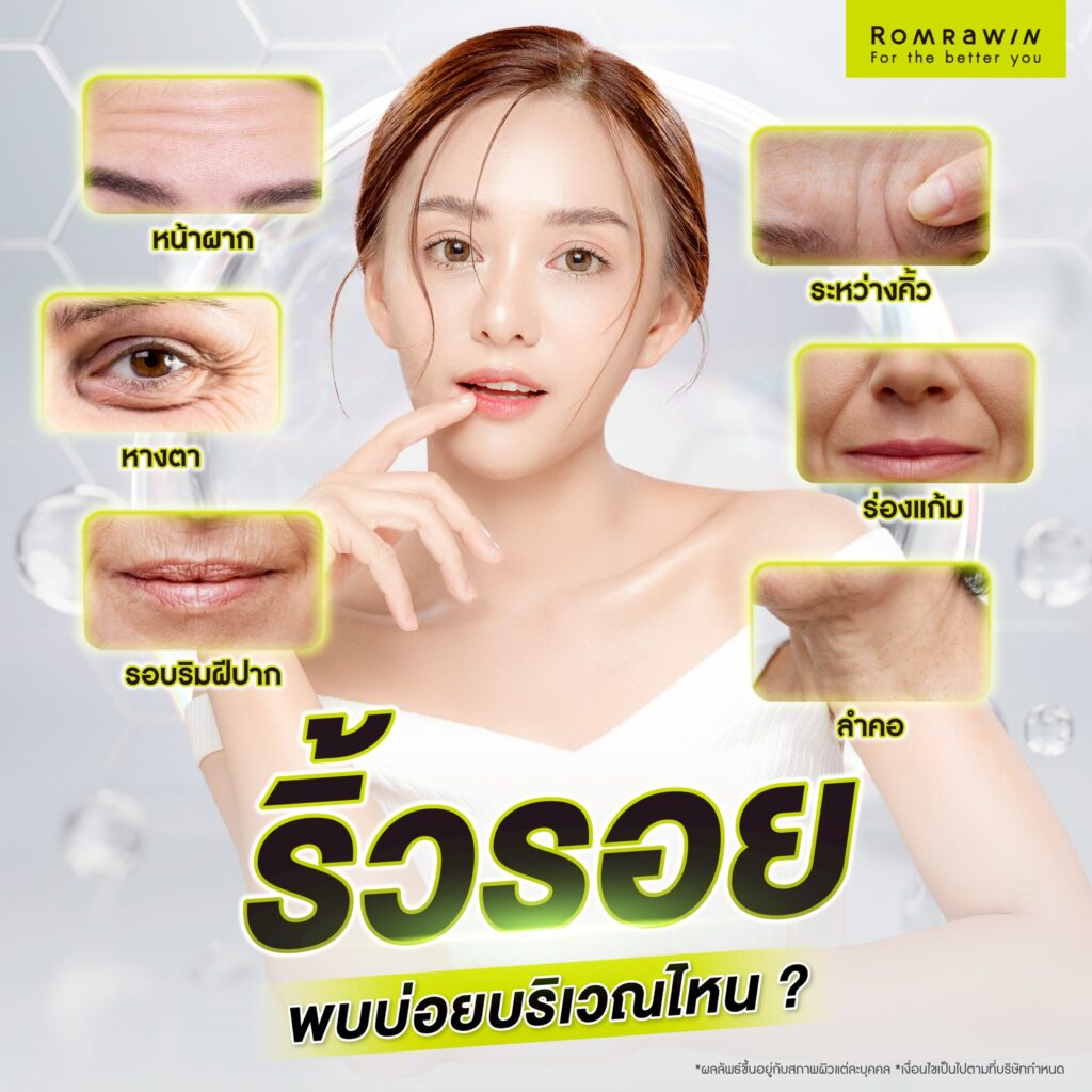 ปัจจัยที่ทำให้เกิดริ้วรอย สาเหตุมาจากอะไร? มีวิธีป้องกันอย่างไร? 4 บริเวณที่มีริ้วรอยเกิดขึ้นบ่อย
