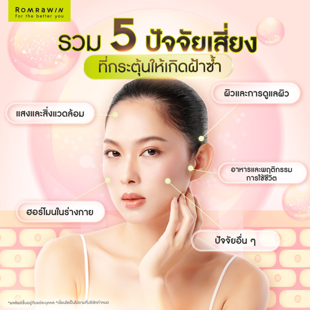 รู้ก่อนเป็น ! วิธีป้องกันฝ้า เพื่อผิวหน้ากระจ่างใสไร้ฝ้า ไม่กลับมาเป็นซ้ำ 2 รวม 5 ปัจจัยเสี่ยงที่กระตุ้นให้เกิดฝ้าซ้ำ