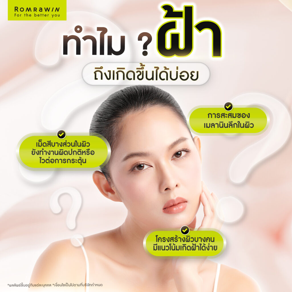 รู้ก่อนเป็น ! วิธีป้องกันฝ้า เพื่อผิวหน้ากระจ่างใสไร้ฝ้า ไม่กลับมาเป็นซ้ำ 5 ทำไมฝ้าถึงเกิดขึ้นได้บ่อย