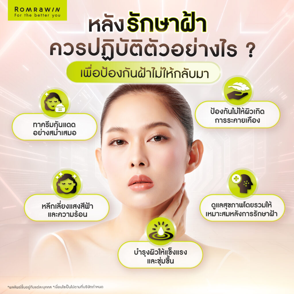 รู้ก่อนเป็น ! วิธีป้องกันฝ้า เพื่อผิวหน้ากระจ่างใสไร้ฝ้า ไม่กลับมาเป็นซ้ำ 6 หลังรักษาฝ้าควรปฏิบัติตัวอย่างไร? เพื่อป้องกันฝ้าไม่ให้กลับมา