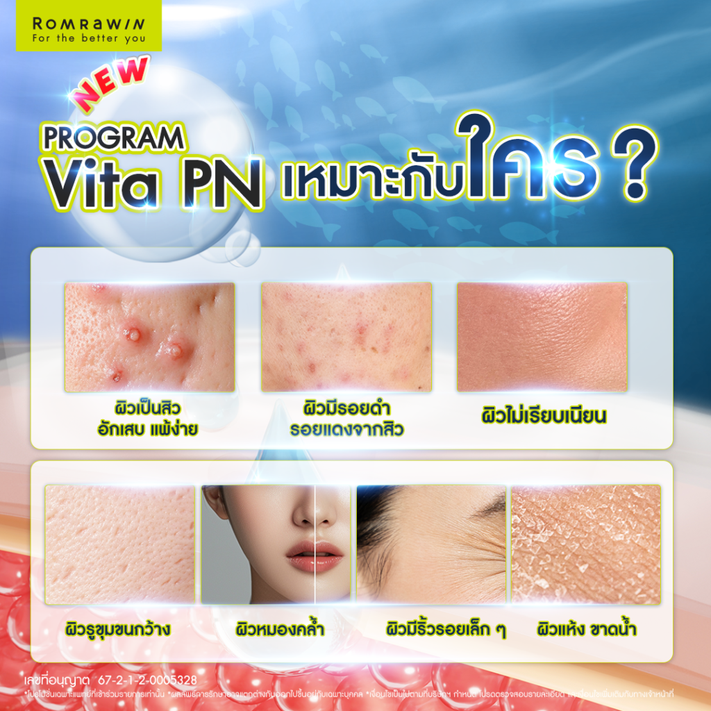 VITARAN I โปรแกรมฟื้นฟูผิวแข็งแรงด้วย Polynucleotide 11 Vitaran I เหมาะกับใคร?