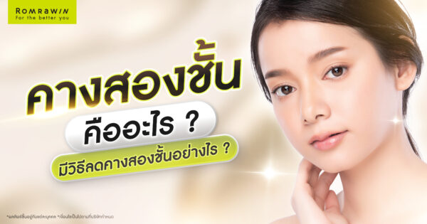 คางสองชั้น