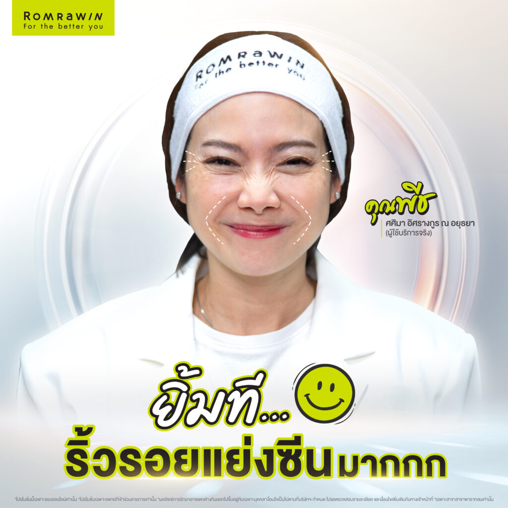 คุณพีชทำโปรแกรมฉีดโบ กาลเวลาหยุดไม่ได้ แต่ริ้วรอยหยุดได้ 3 คุณพีชทำโปรแกรมฉีดโบ กาลเวลาหยุดไม่ได้ แต่ริ้วรอยหยุดได้