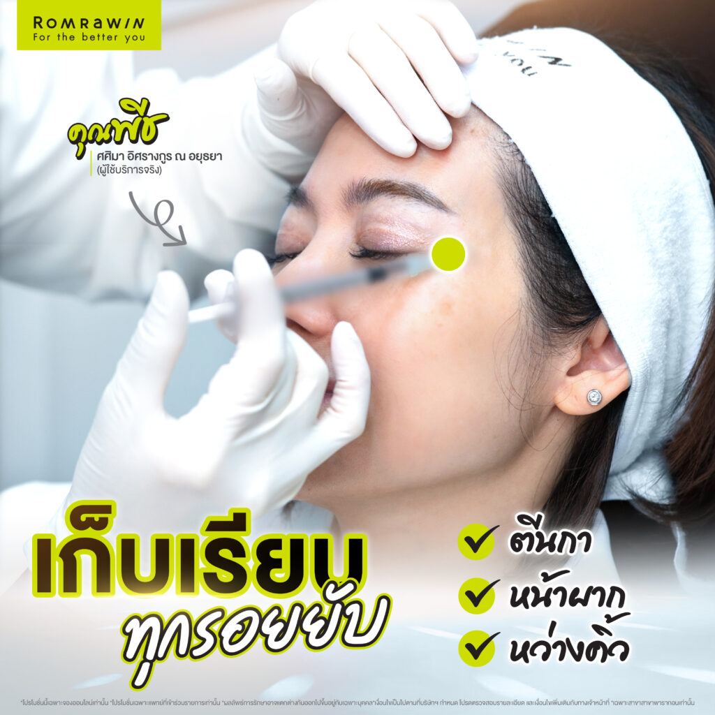 คุณพีชทำโปรแกรมฉีดโบ กาลเวลาหยุดไม่ได้ แต่ริ้วรอยหยุดได้ 2 คุณพีชทำโปรแกรมฉีดโบ กาลเวลาหยุดไม่ได้ แต่ริ้วรอยหยุดได้