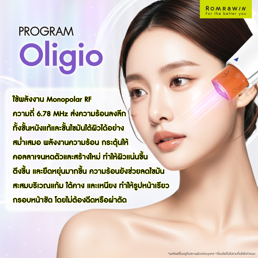 ทำความรู้จักเครื่อง Oligio ยกกระชับ ลดเหนียง