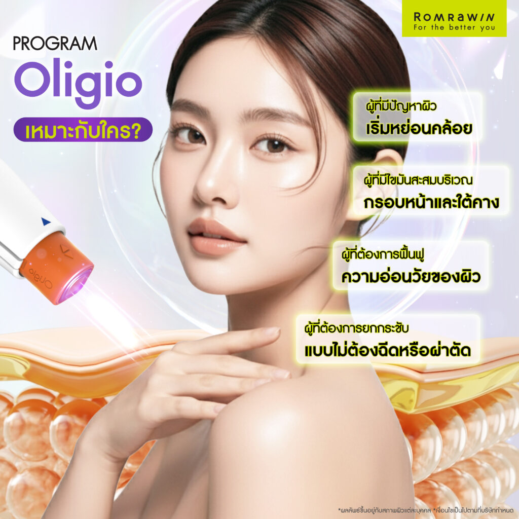ใครบ้างที่เหมาะกับการทำ Oligio ยกกระชับ ลดเหนียง