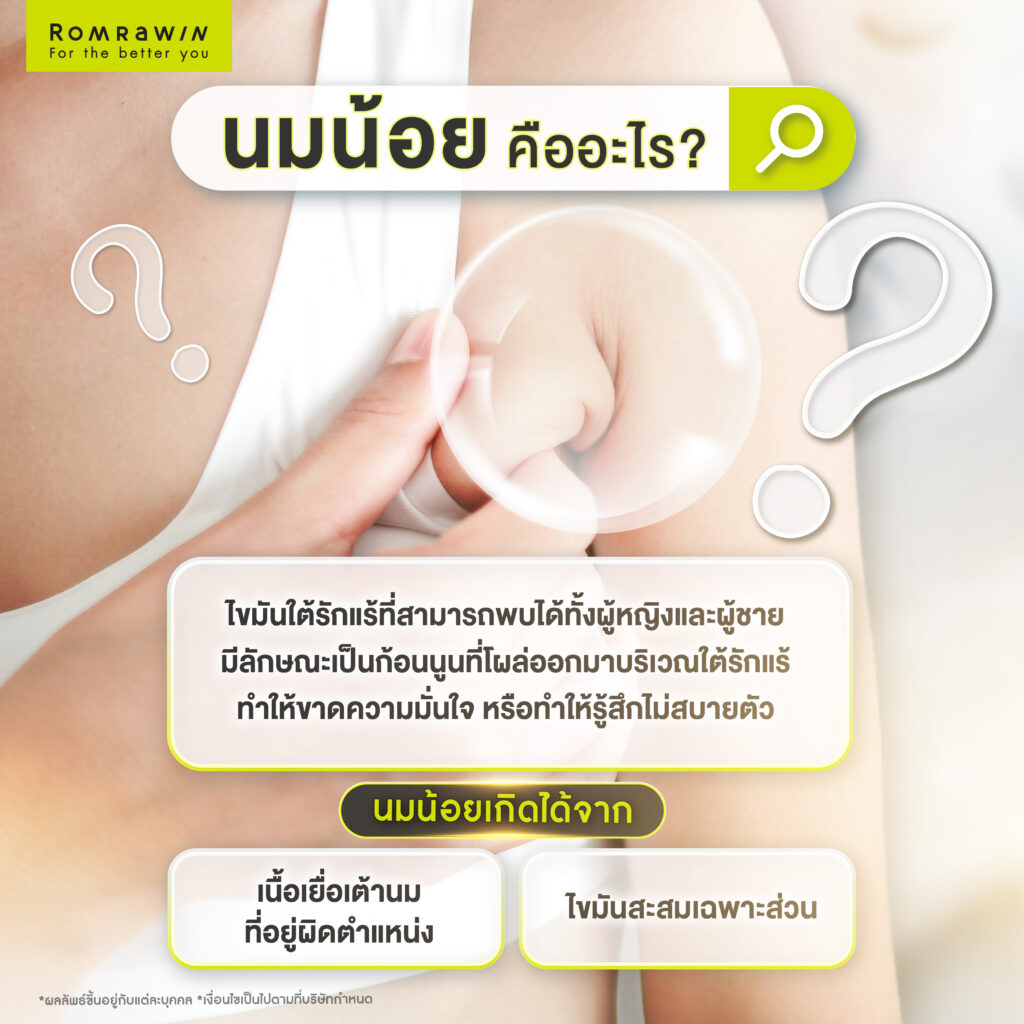 นมน้อย คืออะไร? รู้จักสาเหตุของปัญหา อยากลดไขมันใต้รักแร้ต้องแก้อย่างไร? 2 นมน้อย คืออะไร?