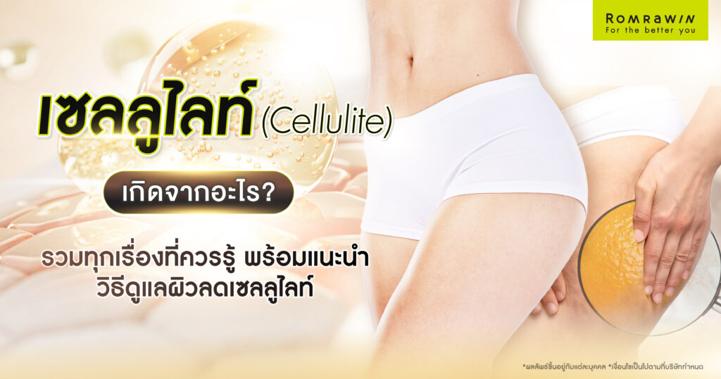 เซลลูไลท์ (Cellulite) เกิดจากอะไร?