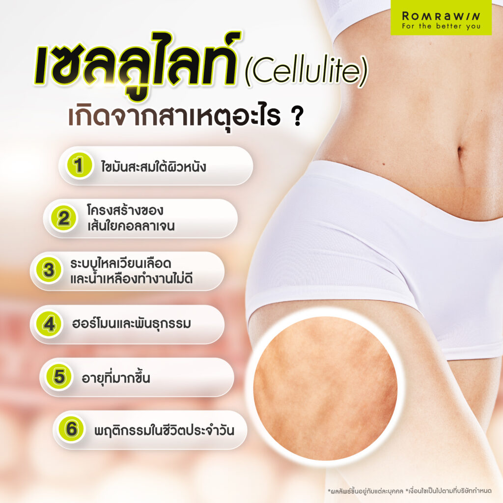 เซลลูไลท์ (Cellulite) เกิดจากสาเหตุอะไร 