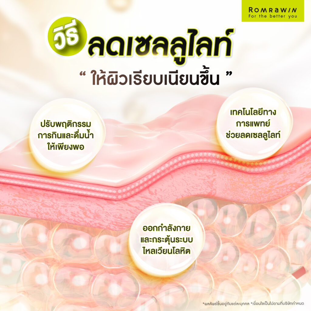 วิธีลดเซลลูไลท์ (Cellulite) ให้ผิวเรียบเนียนขึ้น