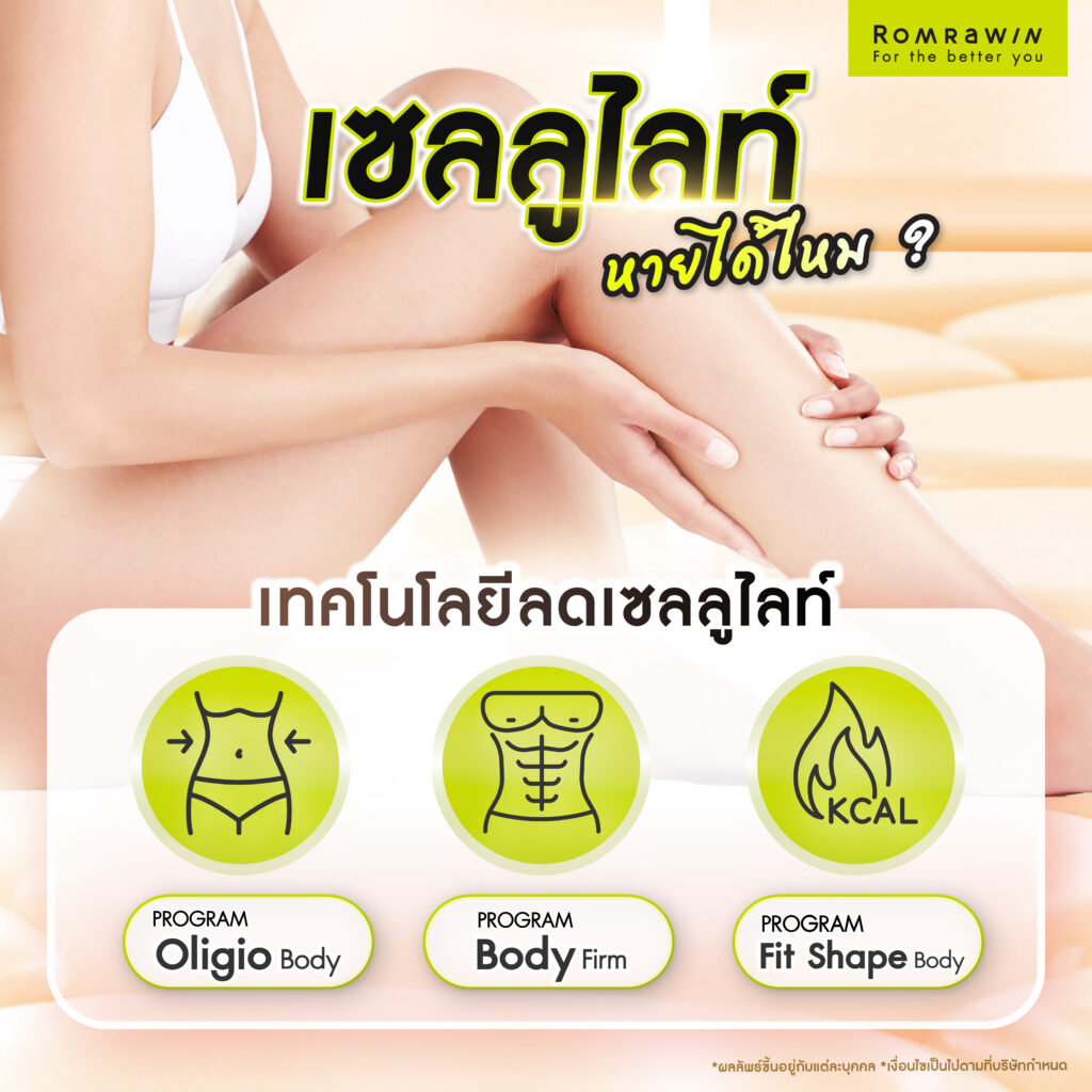 เซลลูไลท์หายได้ไหม? รวมเทคโนโลยีลดเซลลูไลท์