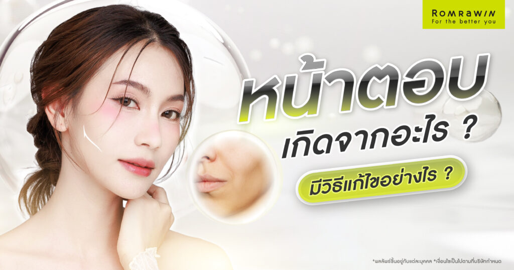 หน้าตอบ