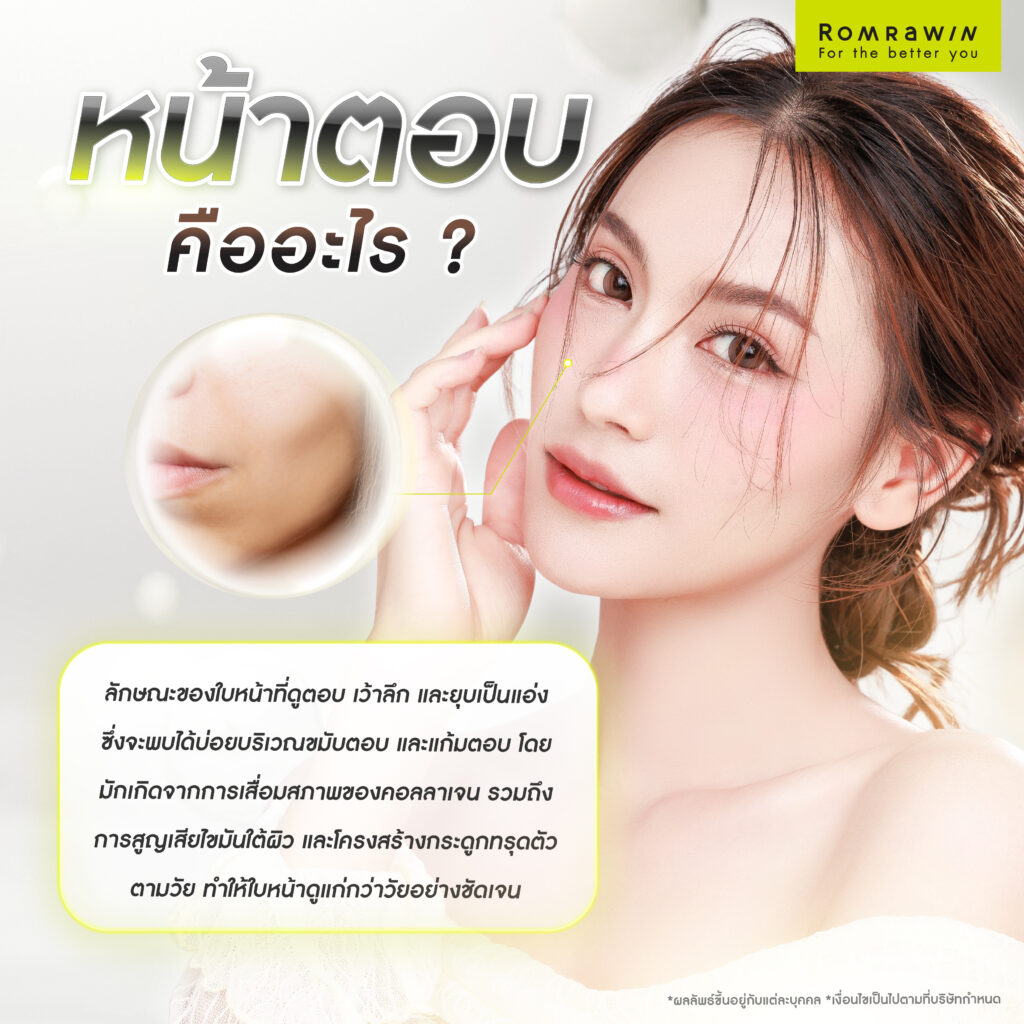 หน้าตอบ คืออะไร?