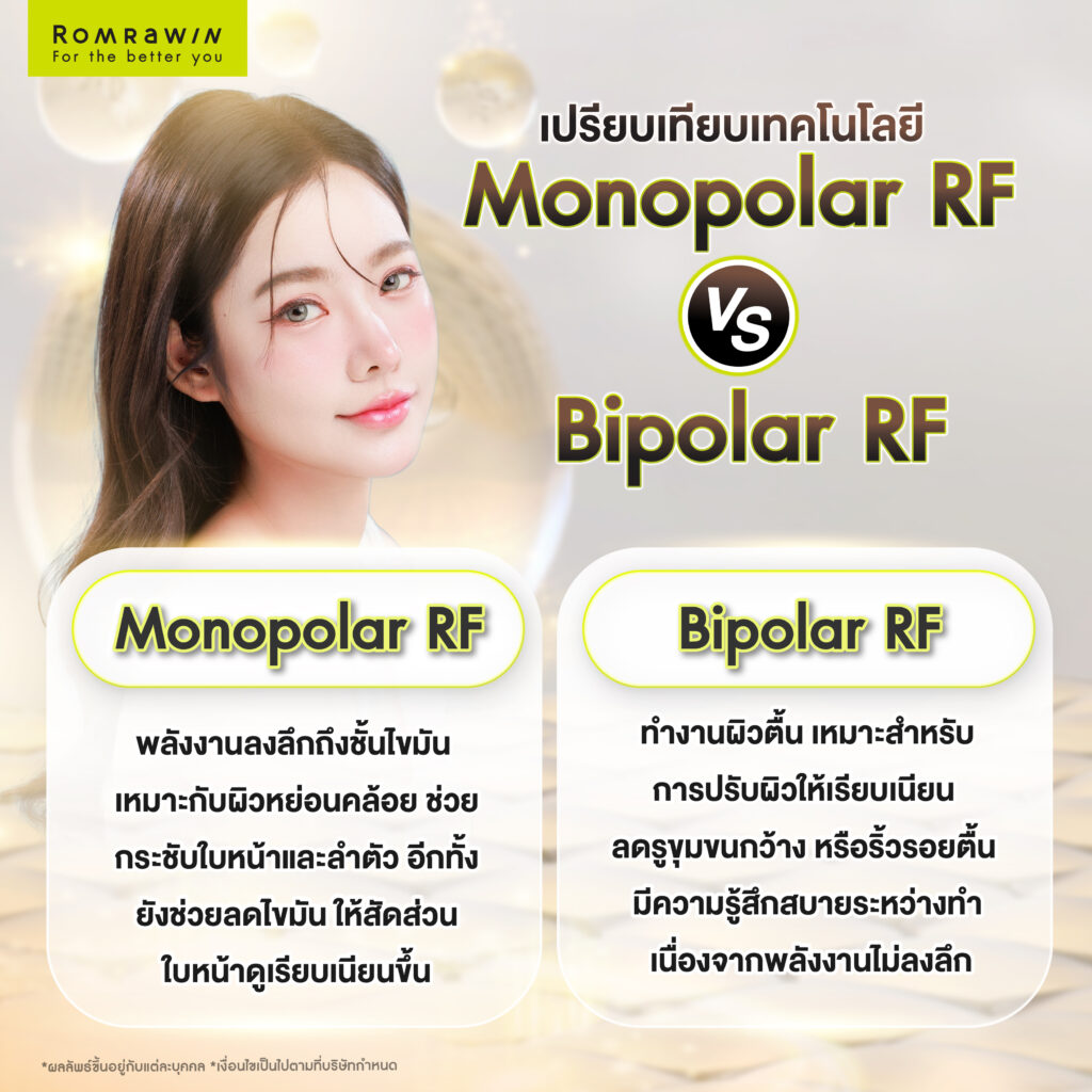 เปรียบเทียบเทคโนโลยี Monopolar RF vs Bipolar RF