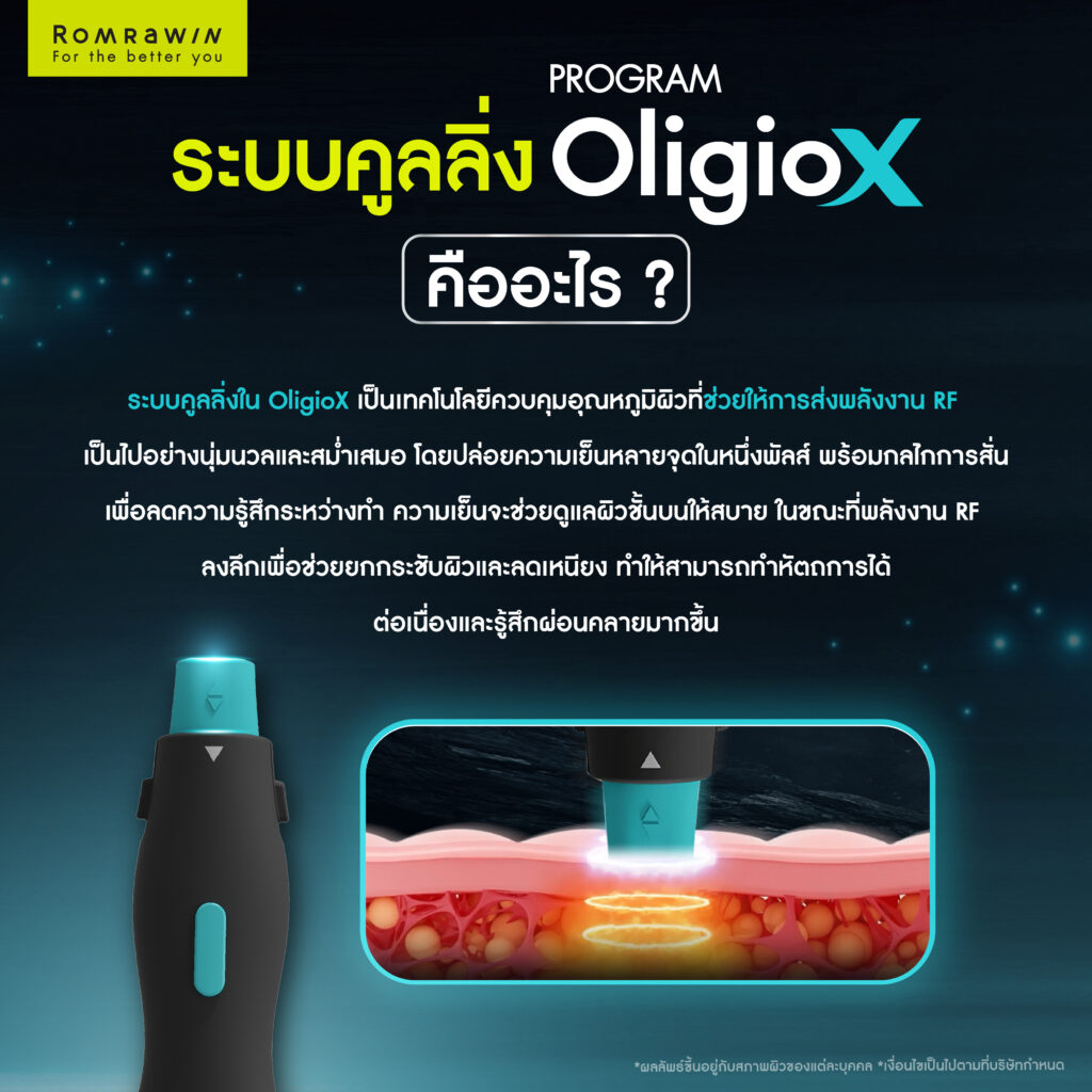 ระบบคูลลิ่งใน OligioX คืออะไร?