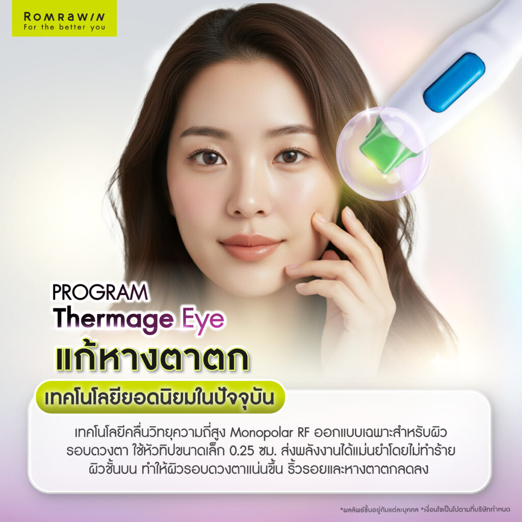 ปัญหาหางตาตกที่มากับวัย Thermage Eye แก้หางตาตก ฟื้นฟูผิวรอบดวงตาได้อย่างไร 3 Thermage Eye แก้หางตาตก เทคโนโลยียอดนิยมในปัจจุบัน