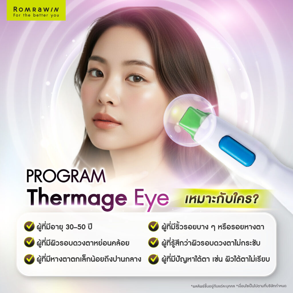 ปัญหาหางตาตกที่มากับวัย Thermage Eye แก้หางตาตก ฟื้นฟูผิวรอบดวงตาได้อย่างไร 5 Thermage Eye เหมาะกับใครบ้าง?