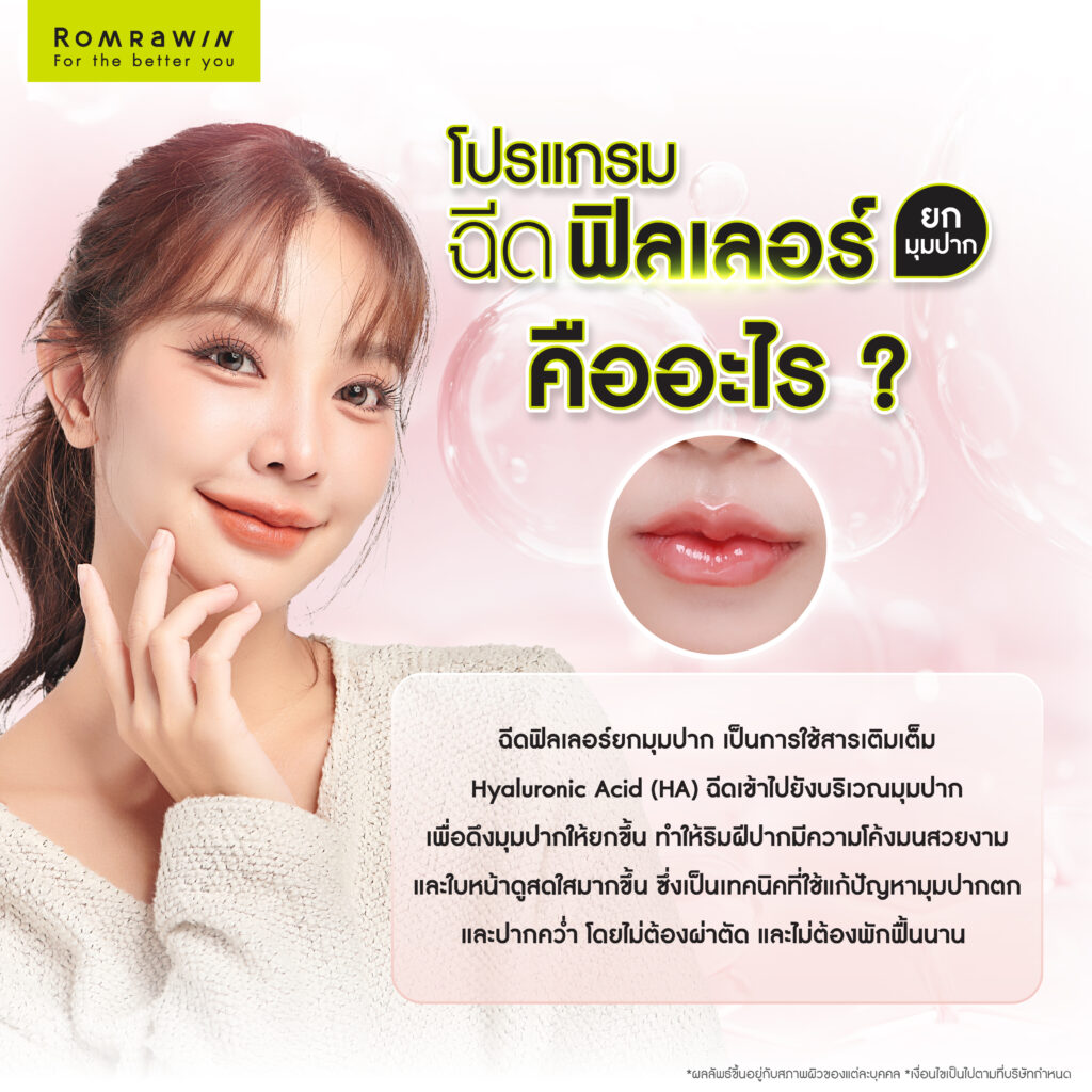 ฉีดฟิลเลอร์ยกมุมปาก คืออะไร?