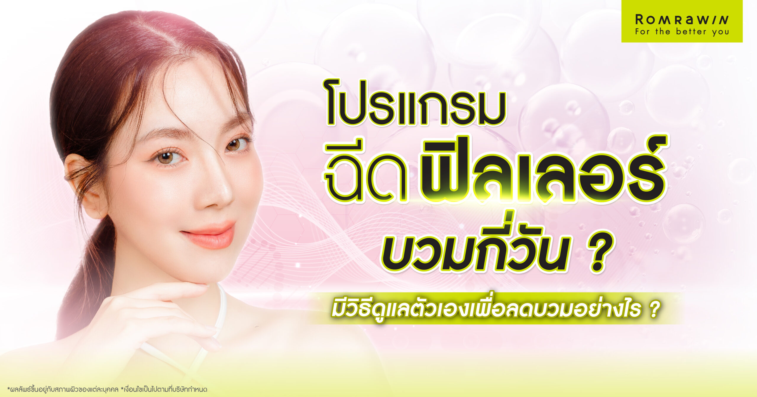 ฉีดฟิลเลอร์แล้วบวมกี่วัน