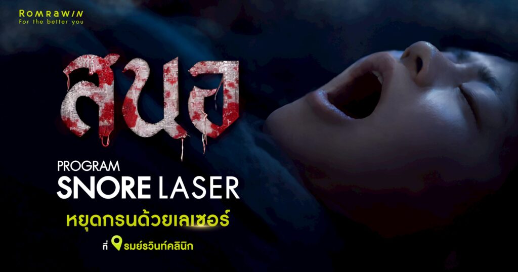 สนอเลเซอร์