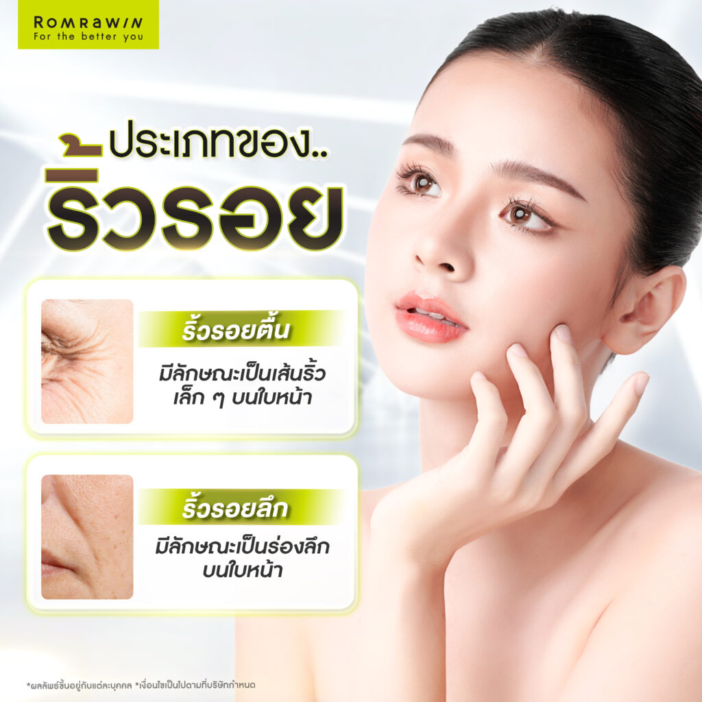 ริ้วรอยเกิดจากอะไร? เจาะลึกถึงสาเหตุของการเกิดริ้วรอยที่ควรรู้ 3 ประเภทของริ้วรอยมีอะไรบ้าง?