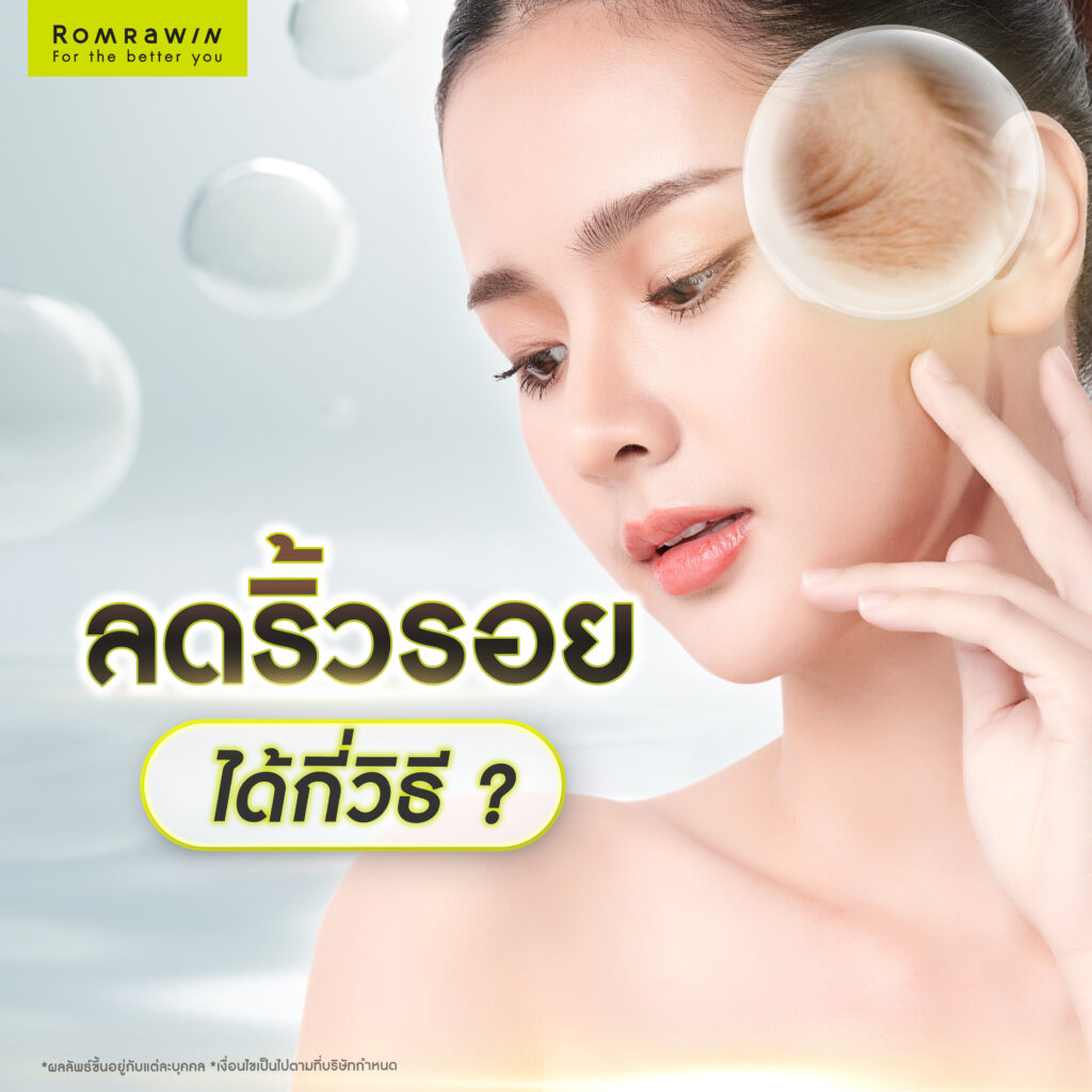 ริ้วรอยเกิดจากอะไร? เจาะลึกถึงสาเหตุของการเกิดริ้วรอยที่ควรรู้ 5 ลดริ้วรอยได้กี่วิธี?