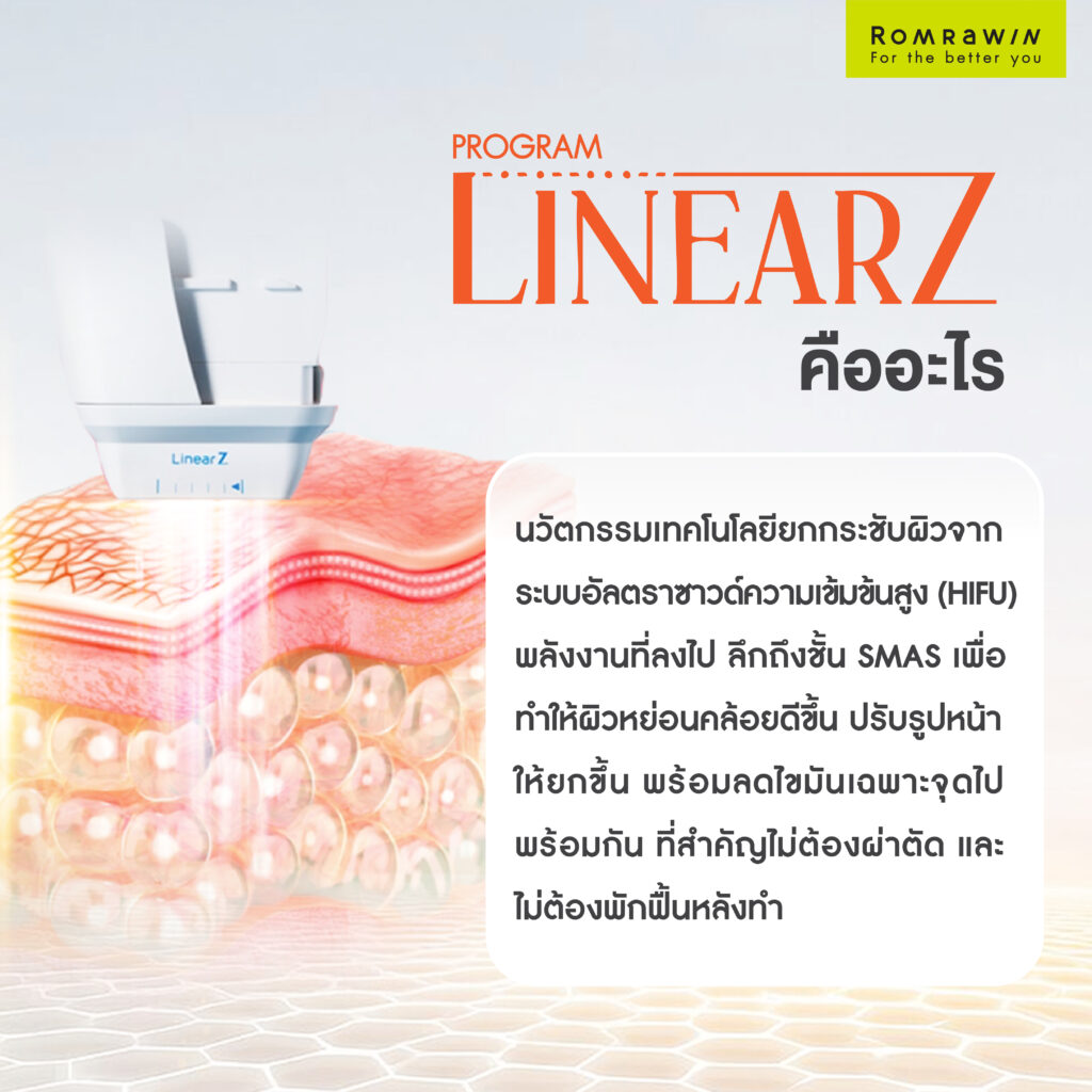 LINEAR Z เทคโนโลยียกกระชับ Custom-designed Lifting กระชับผิวเห็นผลชัด เจ็บน้อย ไม่ต้องพักฟื้น 2 LINEAR Z คืออะไร?