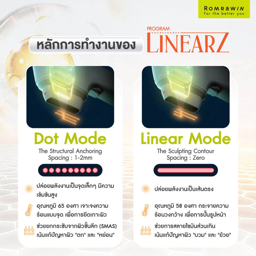 LINEAR Z เทคโนโลยียกกระชับ Custom-designed Lifting กระชับผิวเห็นผลชัด เจ็บน้อย ไม่ต้องพักฟื้น 3 หลักการทำงานของ LINEAR Z