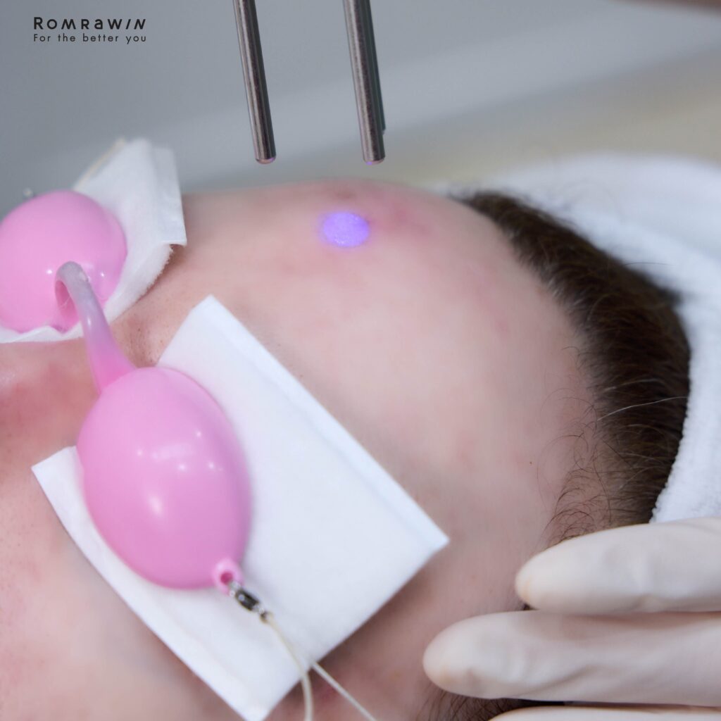 คลาวเดียร์ จักรพันธ์ ประสบอุบัติเหตุอัปเดตอาการหลัง ฟื้นฟูทั้งร่างกายและผิวหน้า ภายใต้การดูแลแพทย์อย่างใกล้ชิด 3 คลาวเดียร์ จักรพันธ์ ประสบอุบัติเหตุอัปเดตอาการ