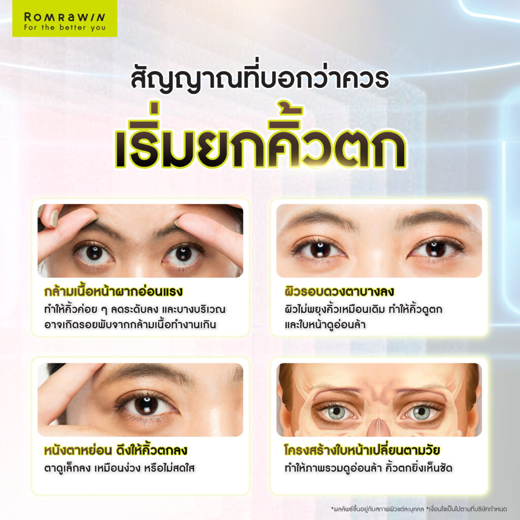 ยกคิ้วตก ฟื้นฟูลึกถึงกล้ามเนื้อ ด้วย EMFACE ทางเลือกของคนที่อยากยกคิ้วโดยไม่ต้องพักฟื้น 2 สัญญาณที่บอกว่าคุณควรเริ่มยกคิ้วตก ฟื้นฟูลึกถึงกล้ามเนื้อ