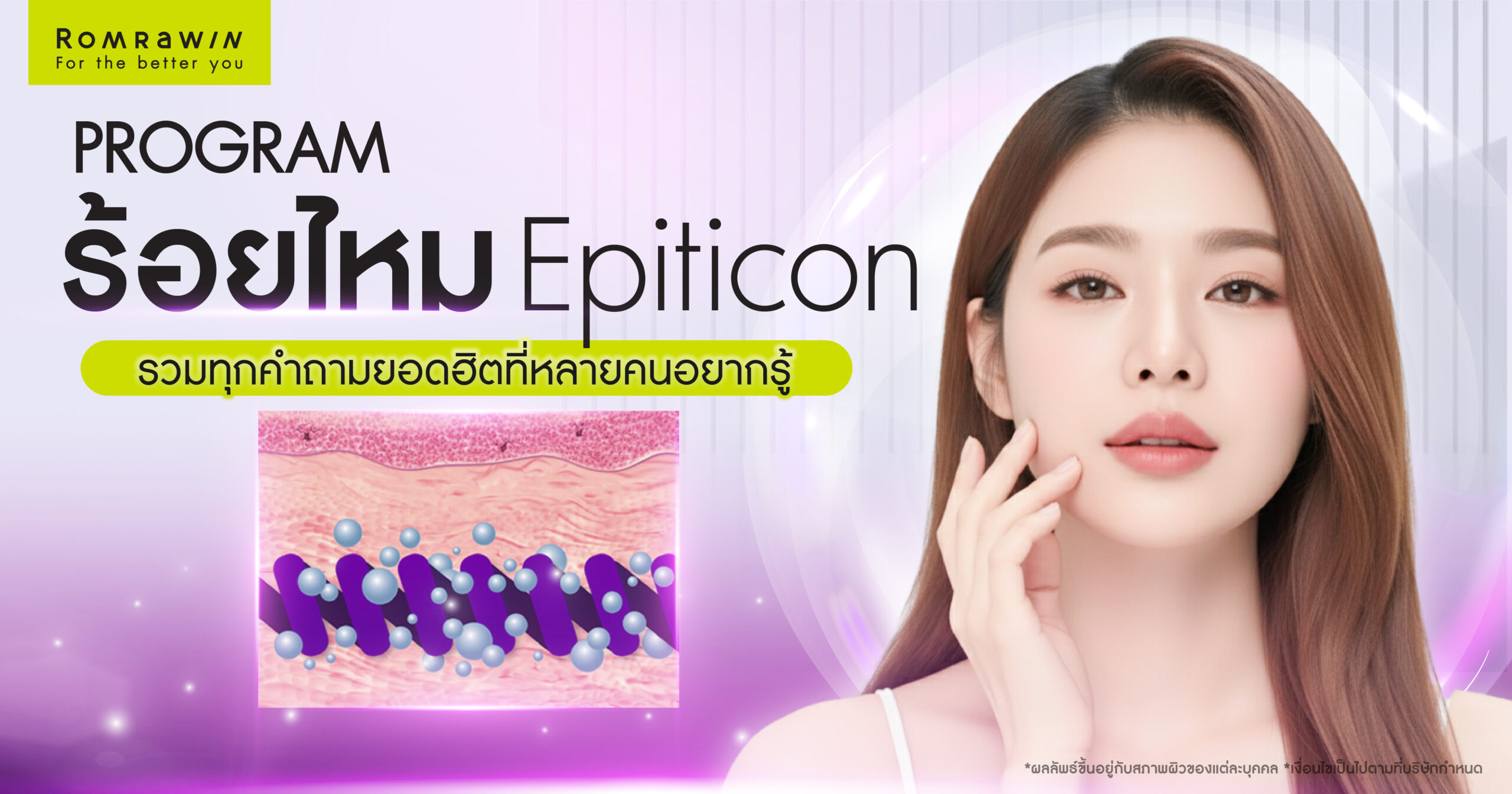 ร้อยไหม Epiticon