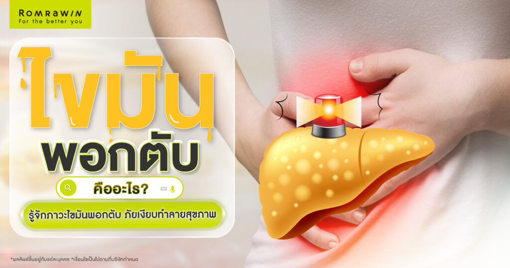 ไขมันพอกตับ (Fatty Liver)