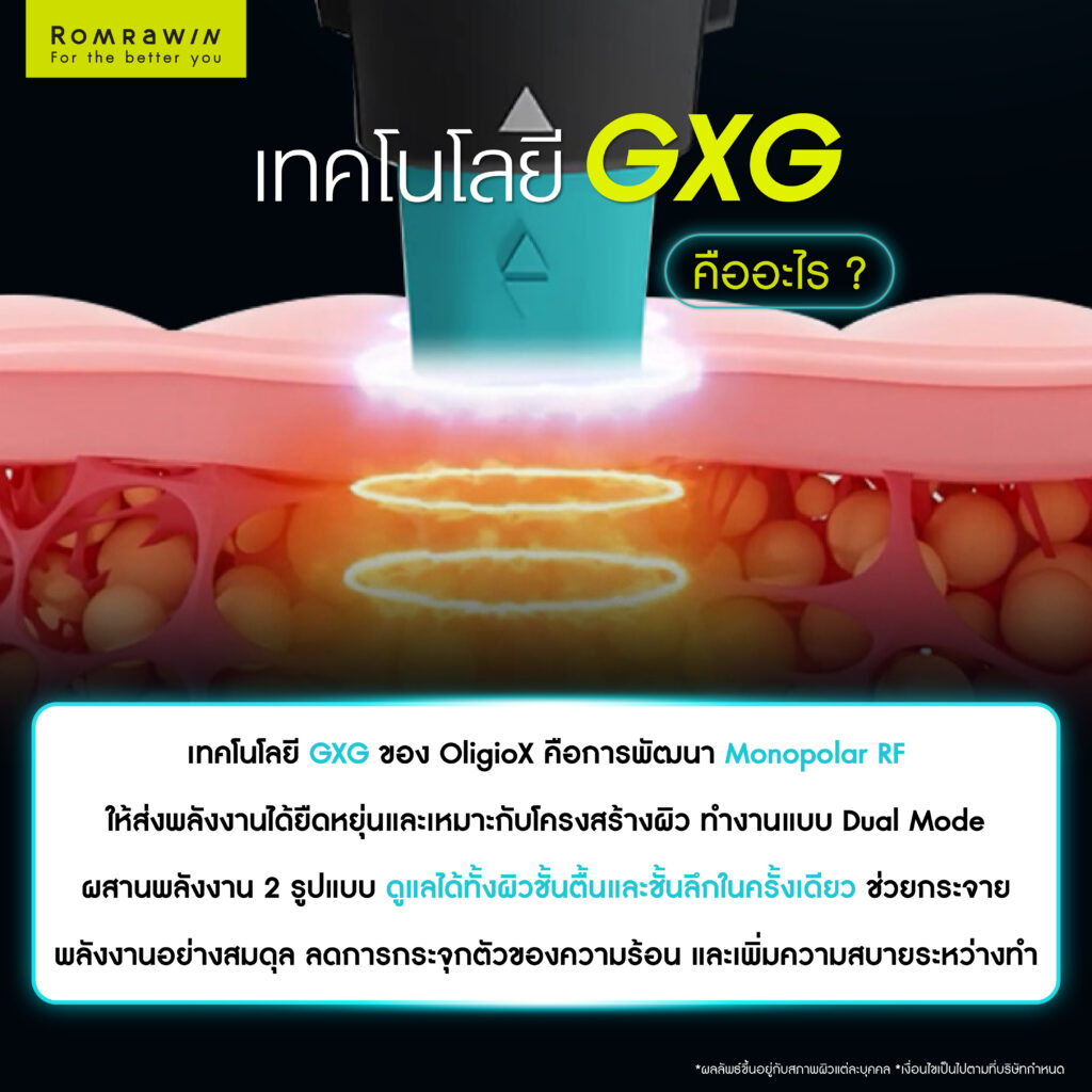 เทคโนโลยี GXG ของ OligioX คืออะไร