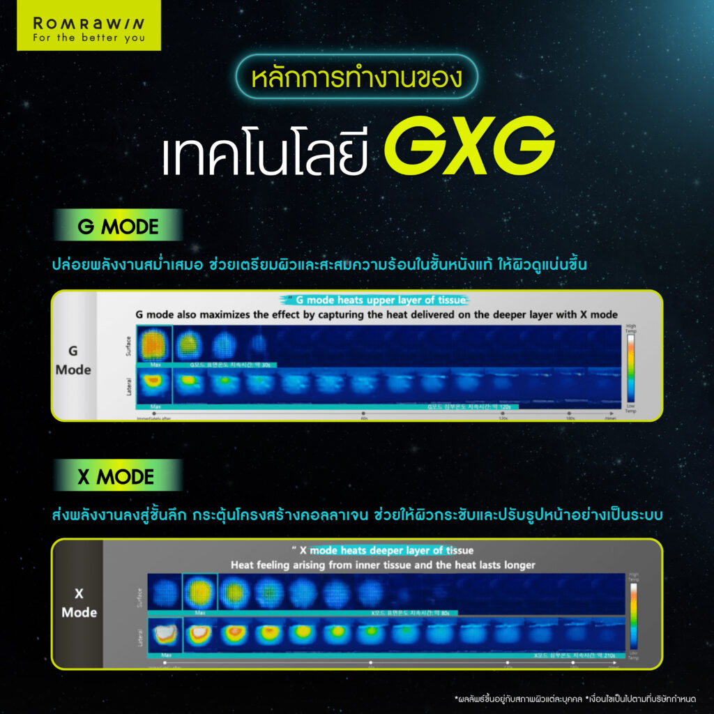 หลักการทำงานของเทคโนโลยี GXG ของ OligioX