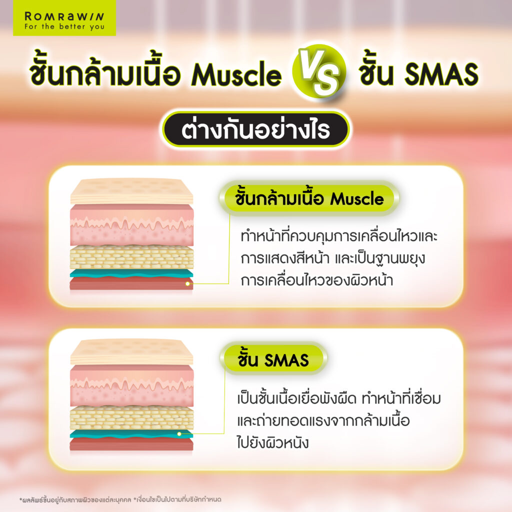 ชั้นกล้ามเนื้อ Muscle คืออะไร? โครงสร้างสำคัญที่มีผลต่อความกระชับของผิวหน้า 6 ชั้นกล้ามเนื้อ Muscle ต่างจากชั้น SMAS อย่างไร