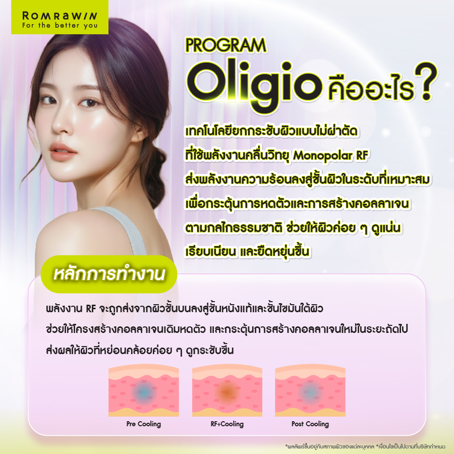 ยกกระชับผิว Oligio เจ็บไหม? รวมทุกคำตอบที่คนกลัวเจ็บควรรู้ 2 ยกกระชับผิว Oligio คืออะไร ทำงานอย่างไร