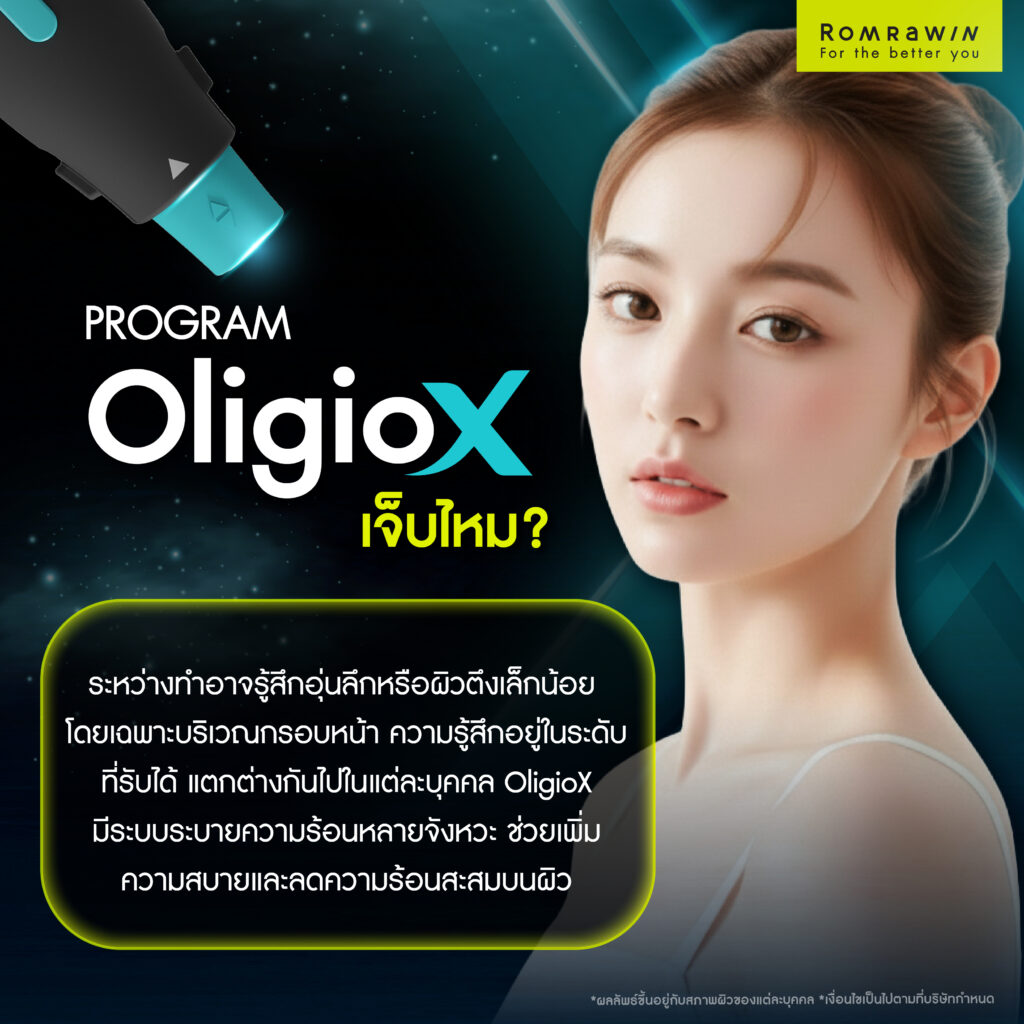 ยกกระชับ OligioX เจ็บไหม? ความกังวลที่พบบ่อยก่อนตัดสินใจทำ