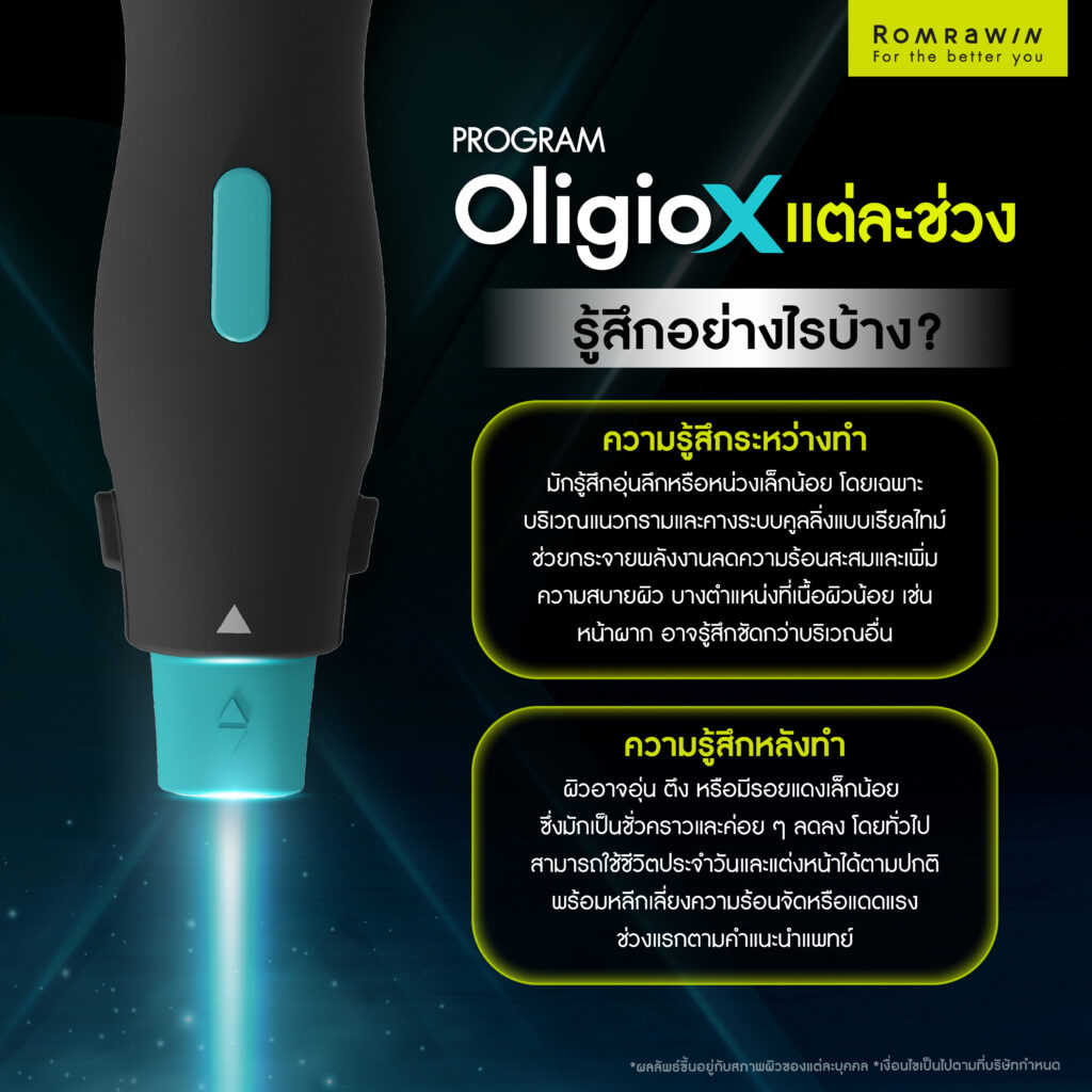 ทำยกกระชับ OligioX แล้วรู้สึกอย่างไรในแต่ละช่วง