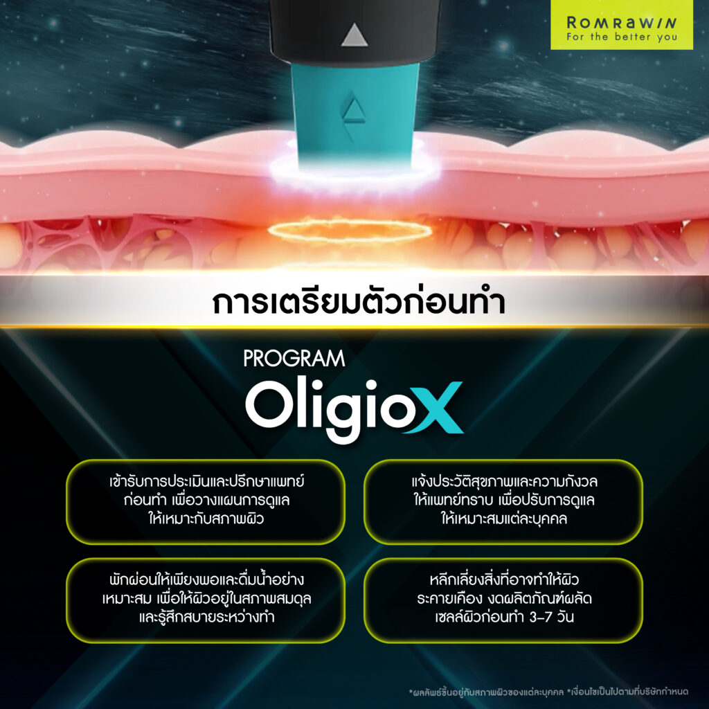 การเตรียมตัวก่อนทำ OligioX เพื่อลดความกังวลเรื่องความเจ็บ 