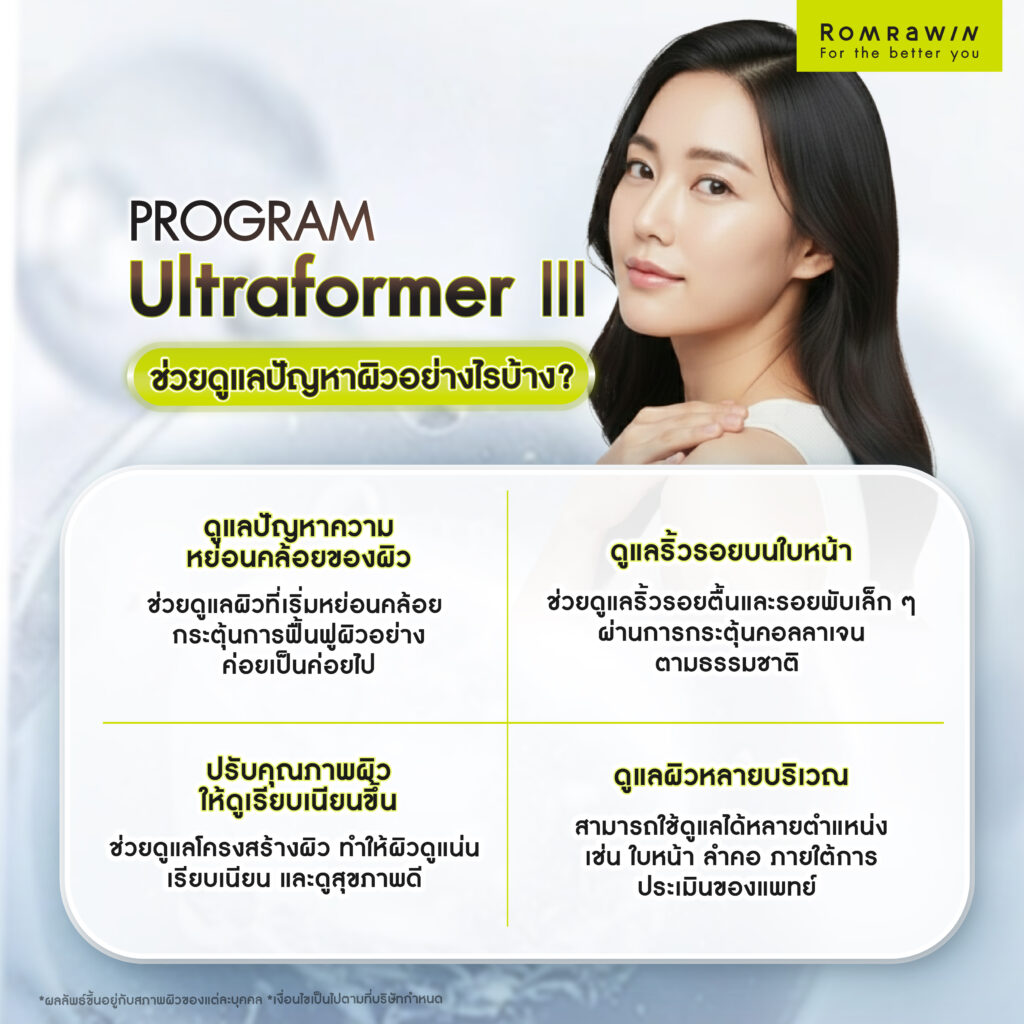 จุดเด่นของเทคโนโลยียกกระชับผิว Ultraformer III